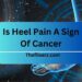 Is Heel Pain A Sign Of Cancer